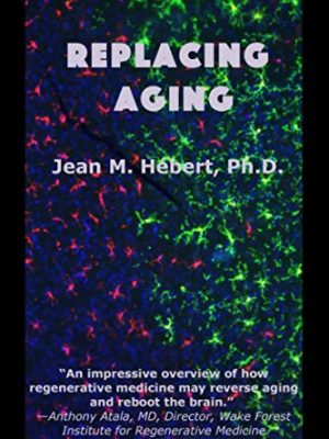 9781513663760_replacing-aging_front-1.jpg Replacing aging