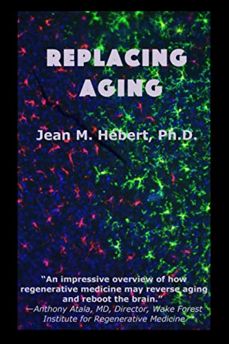 9781513663760_replacing-aging_front-1.jpg Replacing aging