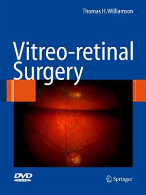 Vitreoretinal surgery