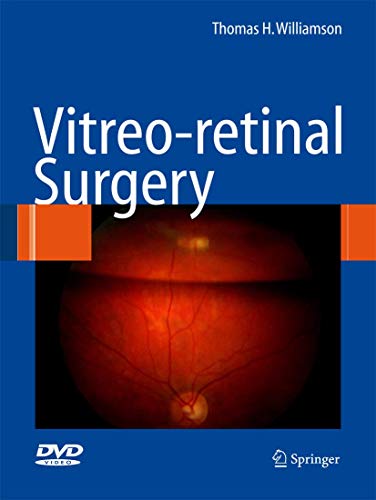 9783540375814_vitreoretinal-surgery_front-1.jpg Vitreoretinal surgery