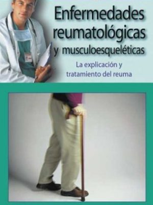 Enfermedades reumatológicas y musculoesqueléticas: la explicación y tratamiento del reuma (médico en casa series)